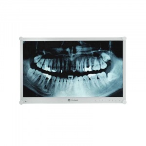 1743567323901-agneovodr24gleddisplay605cm2381920x1080pixelfullhdlcdbianco