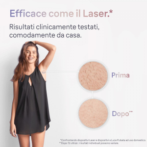 17453954116901-braunepilatorelucepulsatasmartskiniexpertepilazioneacasatuacustodiarasoiodonnavenus2testinepl7147