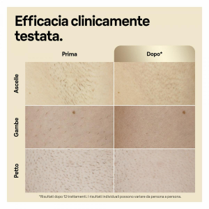 17455467256582-braunepilatorelucepulsatasilkexpertpro5epilazioneacasatuaconcustodiarasoiodonnavenus2testinepl5152